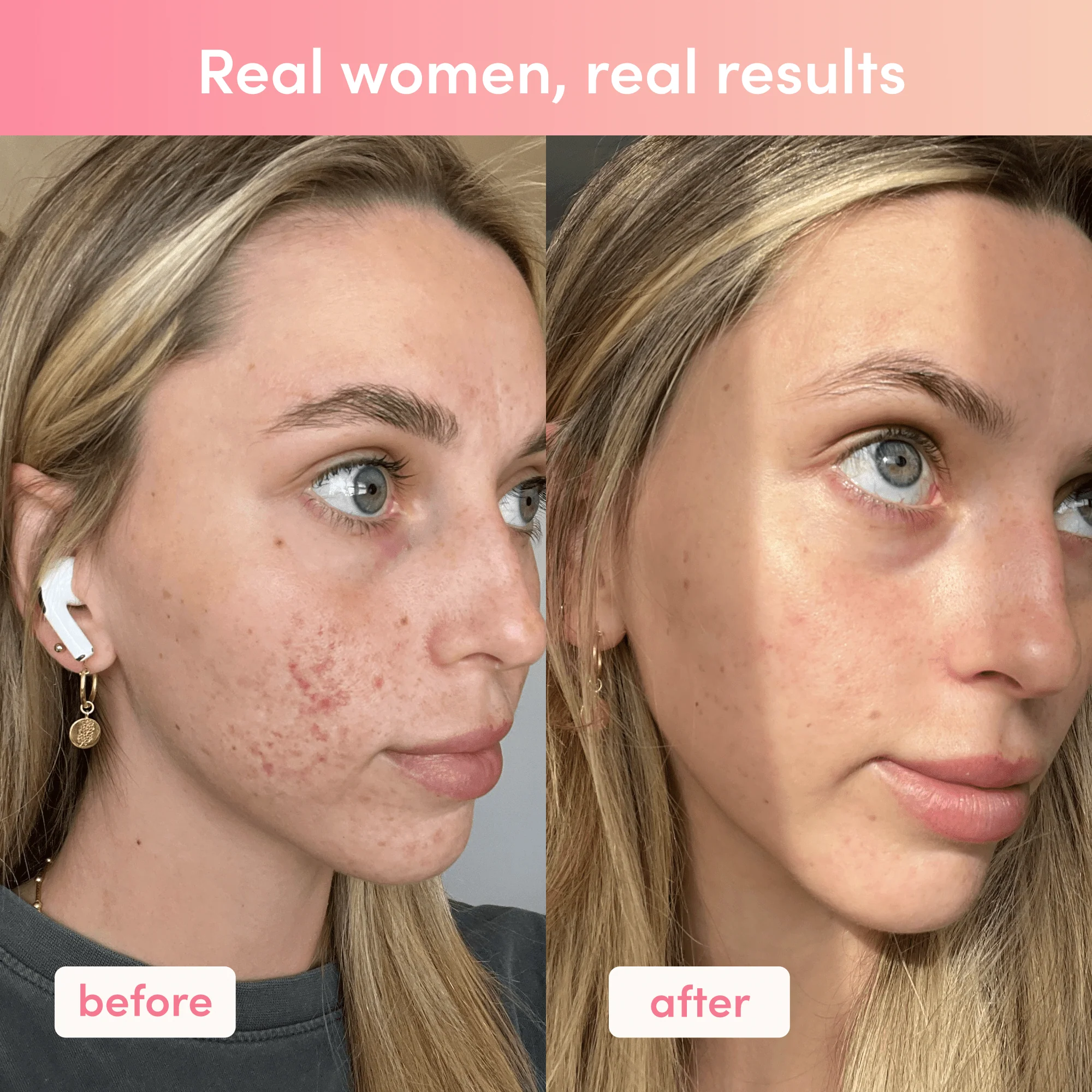 Passionfruit Mango Collagen Powder - 280g - Image 9