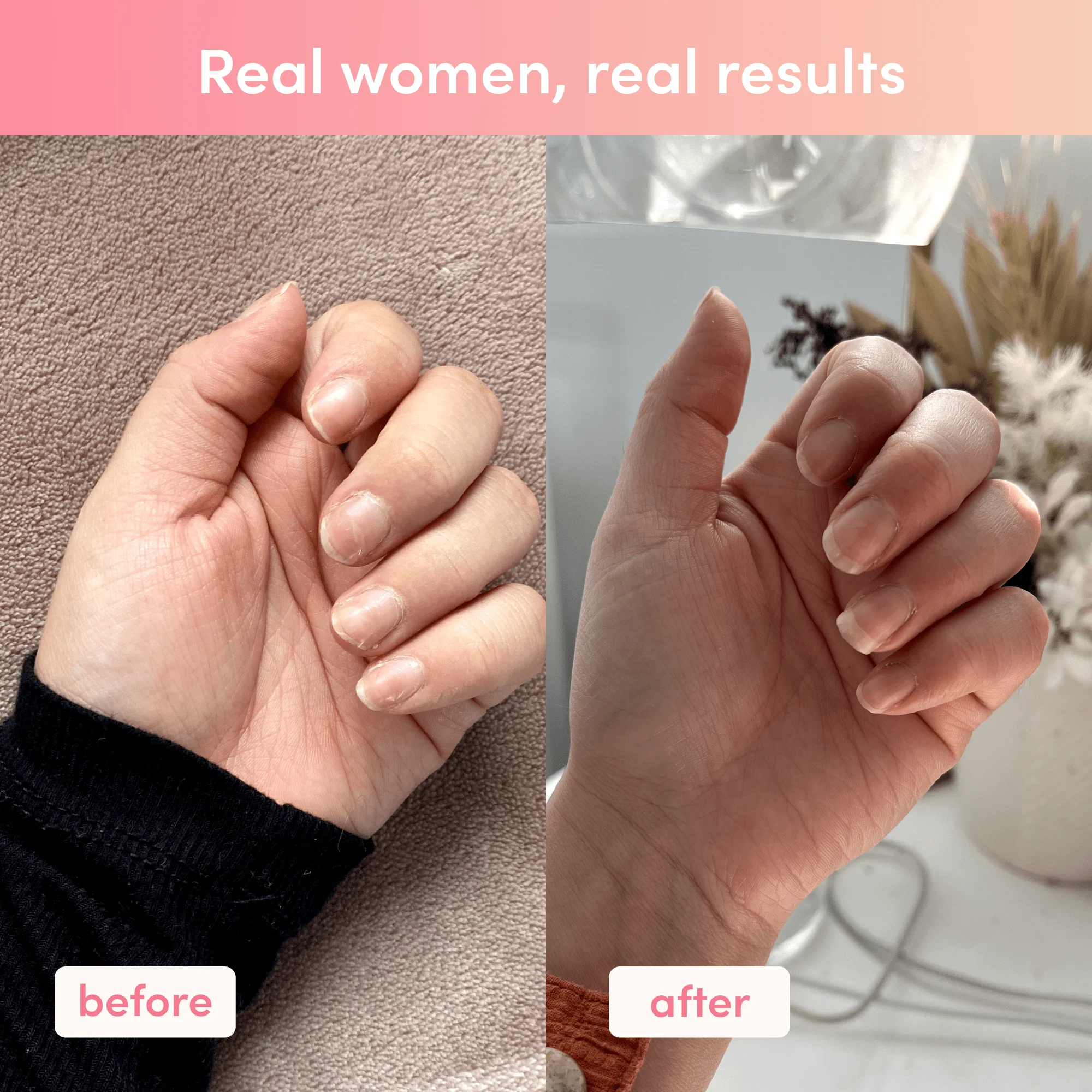 Custom Shine Bright Bundle - Image 10