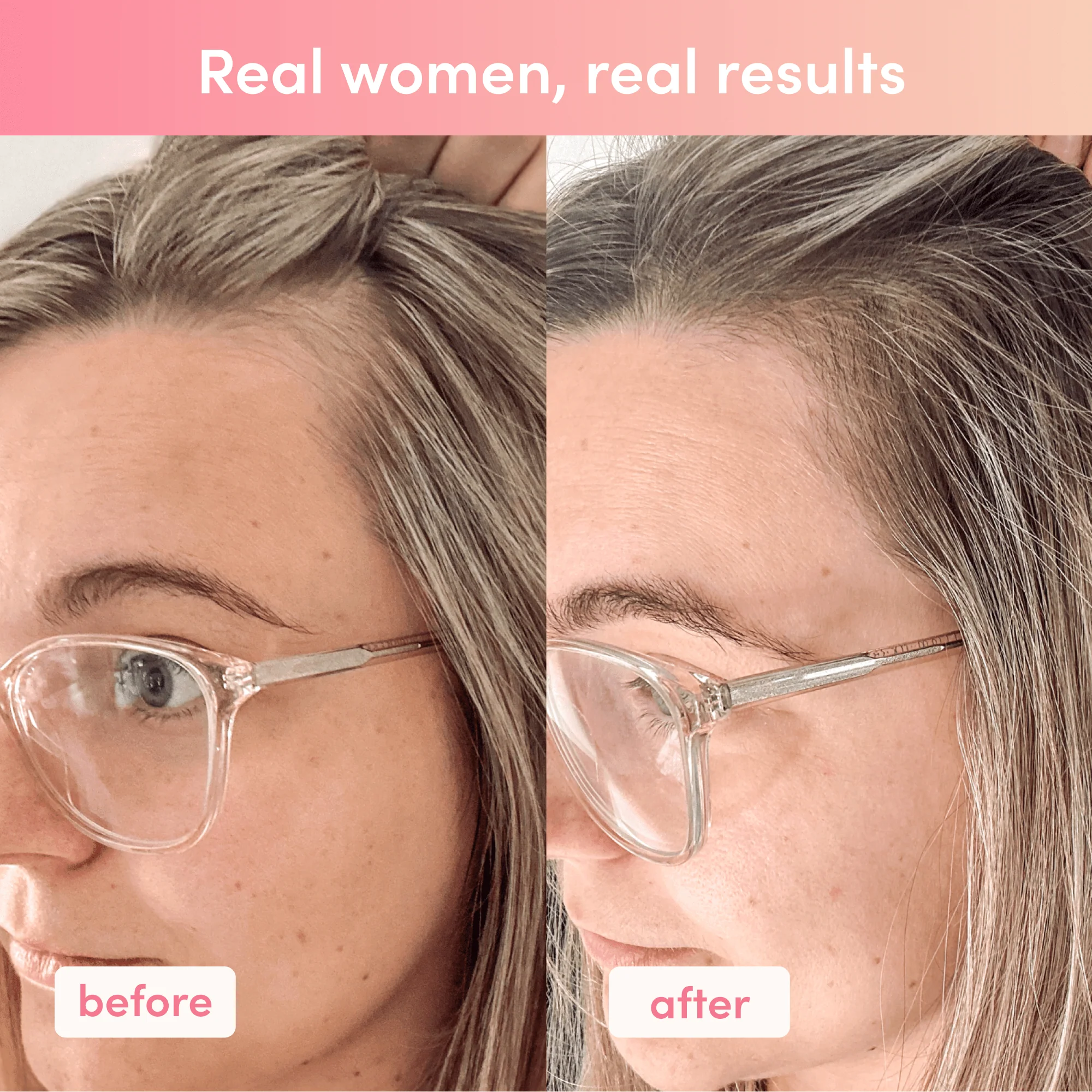 Custom Shine Bright Bundle - Image 6